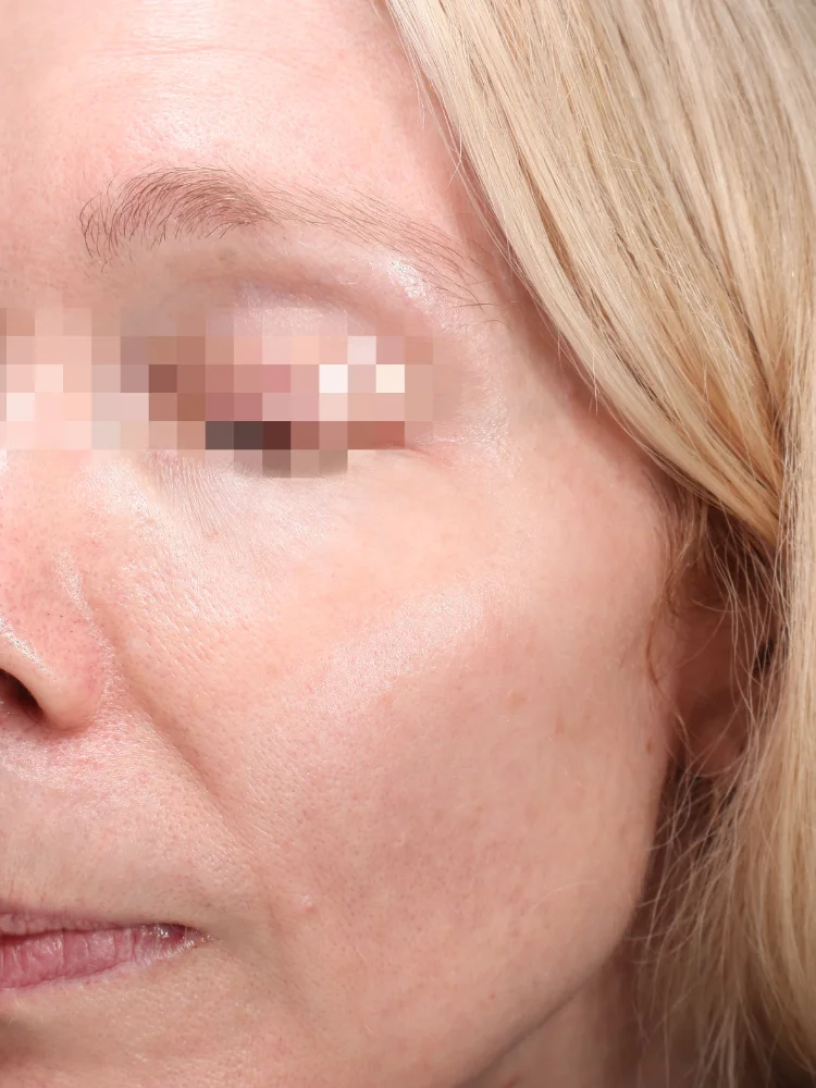 Client 1 AFTER