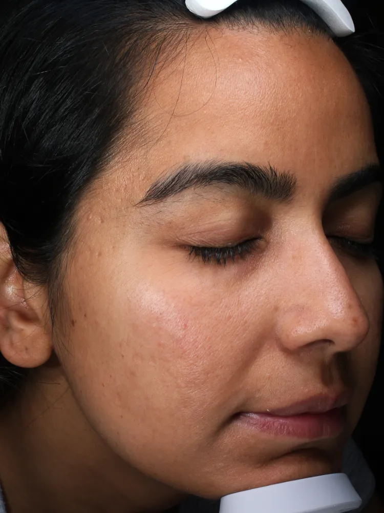 Manisha AFTER