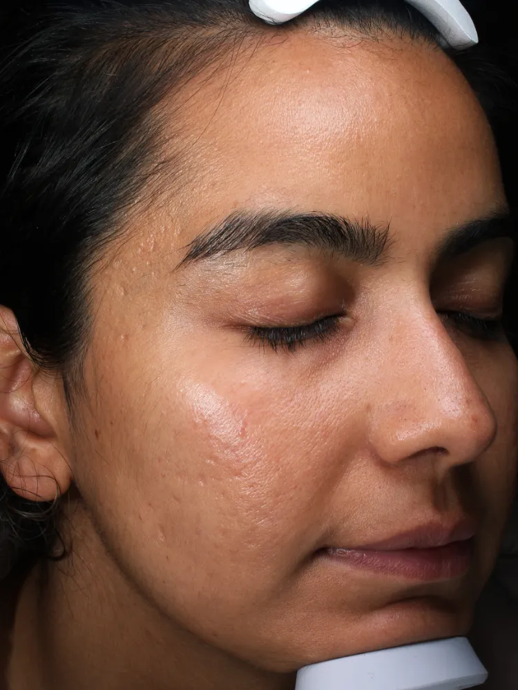 Manisha BEFORE